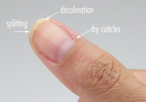 Nail-Medic-3-stappen-naar-gezond-nagels-voor-pic-4