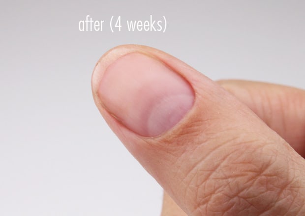 Nail-Medic-3-stappen-naar-gezond-nagels-na-pic-10