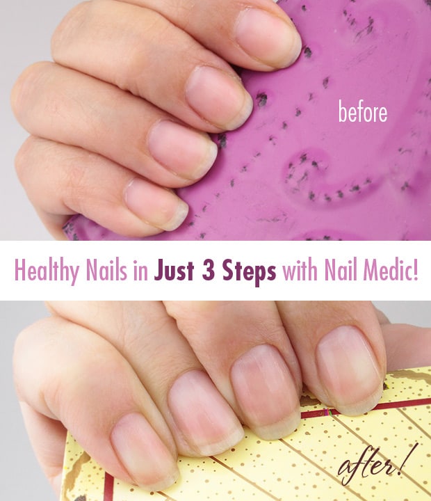 Nail-Medic-3-stappen-naar-Gezond-nagels-11